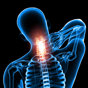 Chiropractic Solutions for Chronic Neck Pain Vancouver's Trusted Experts