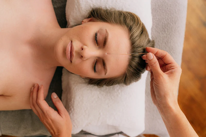 Vancouver Acupuncture